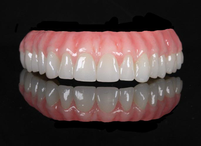 teeth in a day hybrid